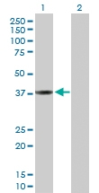H00001514-D01P - Cathepsin L1