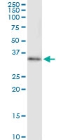 H00001520-D01 - Cathepsin S