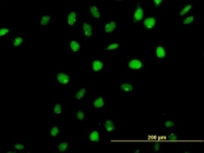 H00001523-B01P - Protein CASP