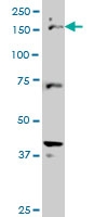 H00001523-M02 - CUTL1 / CDP