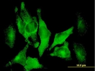 H00001601-B01P - DAB2 / DOC2
