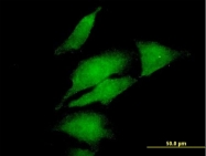 H00001606-B01P - DAG kinase alpha