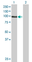 H00001608-B01 - DAG kinase gamma