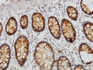H00001615-M01 - DARS1