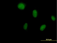 H00001633-B01P - Deoxycytidine kinase