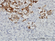 H00001634-M01 - Decorin