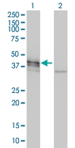 H00001641-M01 - Doublecortin