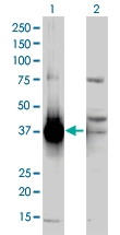 H00001646-A01 - AKR1C2 / DDH2