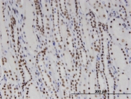 H00001663-M03 - DDX11