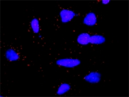 H00001739-M01 - DLG1