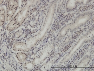 H00001746-M01 - DLX2