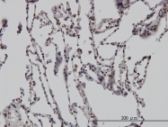 H00001746-M02 - DLX2