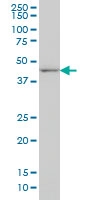 H00001746-M04 - DLX2