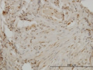 H00001746-M04 - DLX2