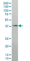 H00001746-M05 - DLX2