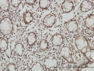 H00001746-M05 - DLX2