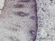H00001746-M06 - DLX2