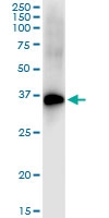 H00001748-D01 - DLX4 / BP1