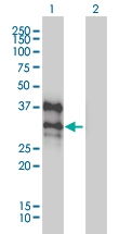 H00001748-M01 - DLX4 / BP1