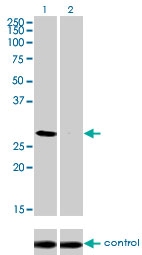 H00001748-M01 - DLX4 / BP1