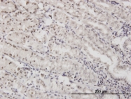 H00001749-M02 - DLX5