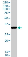 H00001749-M12 - DLX5