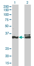 H00001749-M12 - DLX5