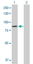 H00001756-D01P - Dystrophin / DMD