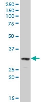 H00001777-A01 - Deoxyribonuclease-2-alpha