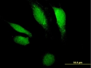 H00001777-B01P - Deoxyribonuclease-2-alpha