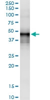 H00001777-D01 - Deoxyribonuclease-2-alpha