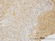 H00001809-M01 - DPYSL3 / CRMP4