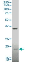 H00001810-A02 - DR1 / NC2-beta
