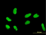 H00001810-B01P - DR1 / NC2-beta