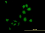 H00001827-B01P - Calcipressin-1