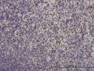H00001831-M01 - TSC22D3