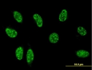 H00001831-M01 - TSC22D3