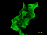 H00001837-B01P - DTNA / DRP3