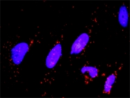 H00001843-M02 - DUSP1 / MKP1
