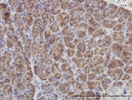 H00001848-M01 - DUSP6