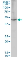 H00001917-A01 - EEF1A2