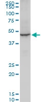 H00001917-A01 - EEF1A2