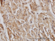 H00001982-M01 - eIF4G2 / DAP5