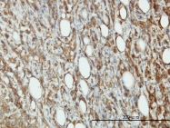 H00001983-M01 - EIF5