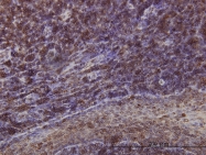 H00002010-M01 - Emerin
