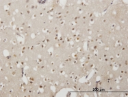 H00002018-M06 - EMX2