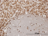 H00002019-M06 - engrailed-1 / EN1