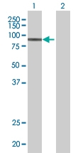 H00002022-B01 - CD105 / Endoglin