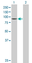 H00002022-D01P - CD105 / Endoglin