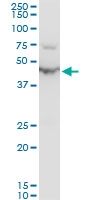 H00002023-A01 - Alpha-enolase / ENO1
